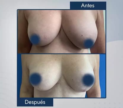 Slider image (6) Dr. Jose E. Telich - Plastic Surgeon